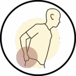 ciática, trocanteritis, tendinitis gluteo